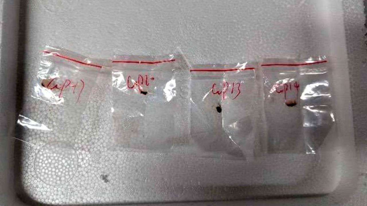 Bio Pathogen